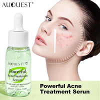 ClearSkin Rejuvenation Serum™