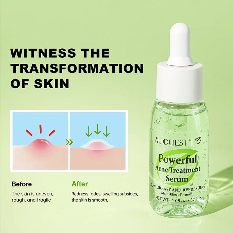 ClearSkin Rejuvenation Serum™